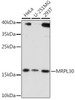 Cell Biology Antibodies 7 Anti-MRPL30 Antibody CAB16529