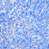 Cell Death Antibodies 1 Anti-STK26 Antibody CAB16534