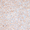 Signal Transduction Antibodies 2 Anti-PMEPA1 Antibody CAB16555