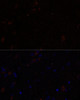Cell Biology Antibodies 7 Anti-KIF17 Antibody CAB16562