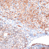 Immunology Antibodies 2 Anti-SLAMF7 Antibody CAB16565