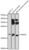 Cell Biology Antibodies 7 Anti-NRN1L Antibody CAB16594