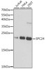 Cell Cycle Antibodies 1 Anti-SPC24 Antibody CAB16601
