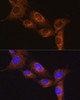 Cell Biology Antibodies 7 Anti-NPB Antibody CAB16612