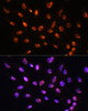 Epigenetics and Nuclear Signaling Antibodies 3 Anti-YY2 Antibody CAB16621