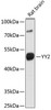 Epigenetics and Nuclear Signaling Antibodies 3 Anti-YY2 Antibody CAB16621