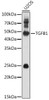 Cell Biology Antibodies 7 Anti-TGFB1 Antibody CAB16640