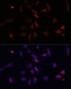 Cell Biology Antibodies 7 Anti-c-Fos Antibody CAB16641