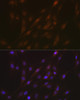 Cell Death Antibodies 1 Anti-ASC / TMS1 Antibody CAB16672