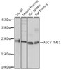 Cell Death Antibodies 1 Anti-ASC / TMS1 Antibody CAB16672