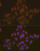 Cell Death Antibodies 1 Anti-ASC / TMS1 Antibody CAB16672