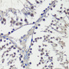Cardiovascular Antibodies Anti-NOTCH1 Antibody CAB16673