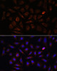 Cardiovascular Antibodies Anti-NRP1 Antibody CAB16697