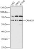ChIP Antibodies Anti-CAMKK1 Antibody CAB16716