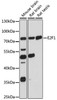 Cell Death Antibodies 1 Anti-E2F1 Antibody CAB16720