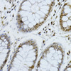 Cell Cycle Antibodies 1 Anti-CDKN1B/p27KIP1 Antibody CAB16722