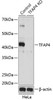 KO Validated Antibodies 1 Anti-TFAP4 Antibody CAB16727KO Validated