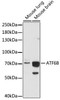 Epigenetics and Nuclear Signaling Antibodies 3 Anti-ATF6B Antibody CAB16742