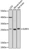 Cell Biology Antibodies 7 Anti-SURF4 Antibody CAB16744