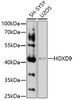 Epigenetics and Nuclear Signaling Antibodies 3 Anti-HOXD9 Antibody CAB16879