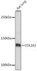 Cell Biology Antibodies 7 Anti-COL1A1 Antibody CAB16891