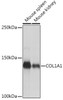 Cell Biology Antibodies 7 Anti-COL1A1 Antibody CAB16891