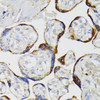 Cell Biology Antibodies 7 Anti-IRS1 Antibody CAB16902