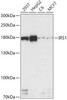 Cell Biology Antibodies 7 Anti-IRS1 Antibody CAB16902
