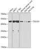 Cell Cycle Antibodies 1 Anti-TSG101 Antibody CAB1692