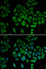 Cell Biology Antibodies 7 Anti-NDUFS1 Antibody CAB16926