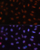 Cell Cycle Antibodies 1 Anti-RB Antibody CAB16966