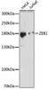 Developmental Biology Anti-ZEB1 Antibody CAB16981