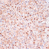 Developmental Biology Anti-ZEB1 Antibody CAB16981