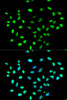 Immunology Antibodies 2 Anti-HNRNPK Antibody CAB1701