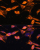 Cell Cycle Antibodies 1 Anti-RAB11A Antibody CAB17031