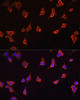 Cell Biology Antibodies 7 Anti-CFL1 Antibody CAB1704