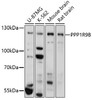 Developmental Biology Anti-PPP1R9B Antibody CAB17229