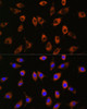 Developmental Biology Anti-PPP1R9B Antibody CAB17230