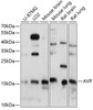 Neuroscience Anti-AVP Antibody CAB1725