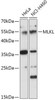 Cell Death Antibodies 1 Anti-MLKL Antibody CAB17312