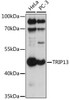 Developmental Biology Anti-TRIP13 Antibody CAB17357