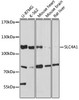 Signal Transduction Antibodies 2 Anti-SLC4A1 Antibody CAB17391