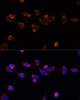 Metabolism Antibodies 2 Anti-PDHA1 Antibody CAB17432