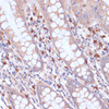 Cell Biology Antibodies 7 Anti-PIK3R2 Antibody CAB17433