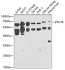 Cell Biology Antibodies 7 Anti-PTH1R Antibody CAB1744