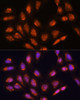 Cell Biology Antibodies 7 Anti-TIMM44 Antibody CAB17446