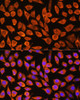 Cell Biology Antibodies 7 Anti-PDXP Antibody CAB17455