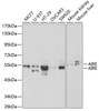 Epigenetics and Nuclear Signaling Antibodies 3 Anti-AIRE Antibody CAB1767