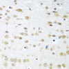 Cell Cycle Antibodies 1 Anti-Cyclin D2 Antibody CAB1773