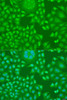 Cell Cycle Antibodies 1 Anti-Cyclin D2 Antibody CAB1773